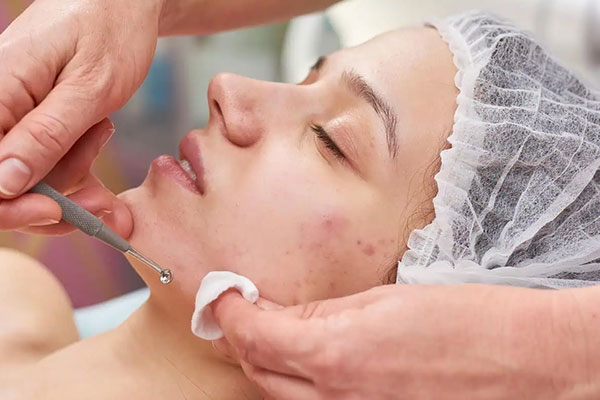 Therapist applying a purifying clay mask during an acne facial treatment