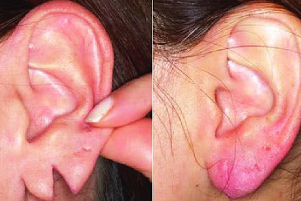 Woman with natural, balanced ear lobes wearing earrings